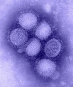 virus H3N2